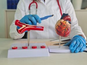 Heart bypass surgery procedure in India showing coronary artery bypass grafting treatment